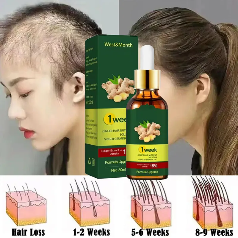 7 Tage Ingwer Haarwuchs Produk – Licorice Root Sticks Bewertung und Preis